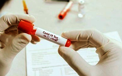 Ανώτατες τιμές μοριακών & rapid τεστ